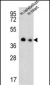 SLC25A19 Antibody (C-term)